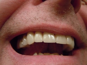 closeup photo of a man's teeth